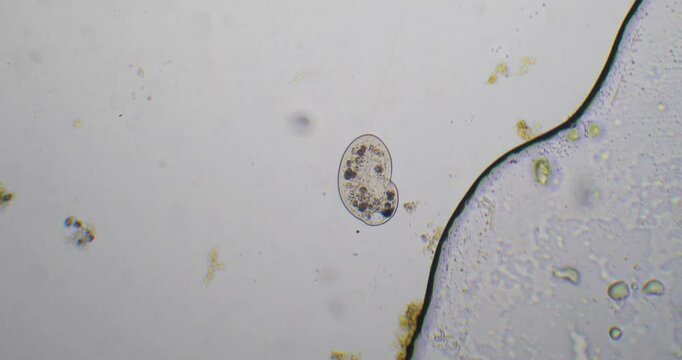 Paramecium aurelia moving in pond water sample