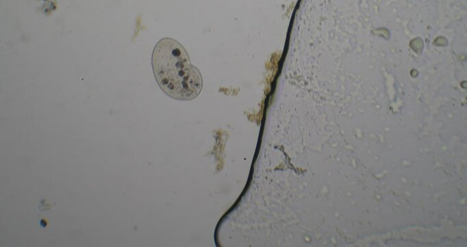 Paramecium aurelia moving near organic debris