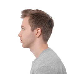 Obraz premium Man before scoliosis treatment on white background