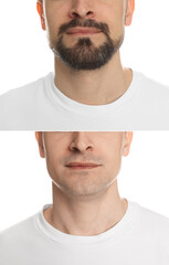 Man before and after shaving on white background, closeup. Collage of photos