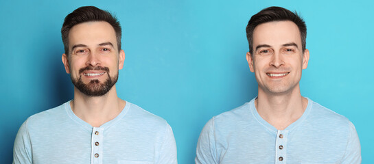 Handsome man before and after shaving on light blue background, collage of photos. Banner design