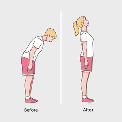 Before and After Posture Comparison, Correcting Posture Illustration, Health and Wellness Concept