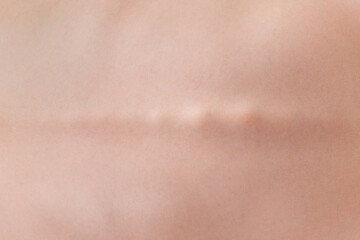 Back of the man with a flat spine.