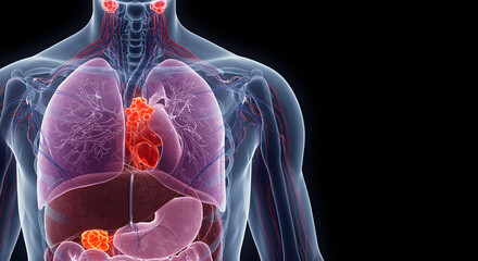 Human Cancer Cell Anatomy: Microscopic View of Disease