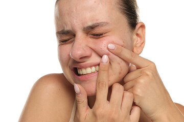 Studio shot of young woman with acne squeezing pimples and expressing pain, isolated on white background
