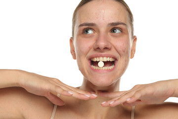 Playful woman with acne showing a pill in her mouth, studio shot on white background.