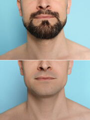 Obraz premium Man before and after shaving on light blue background, closeup. Collage of photos