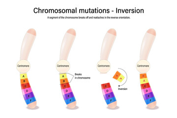 Inversion. Chromosomal mutations. Various genetic disorders. Alteration of chromosome structure. Vector used for scientific and medical education. 