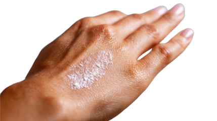 Moisturizing cream applied on hand with natural skin tone, white isolate background.