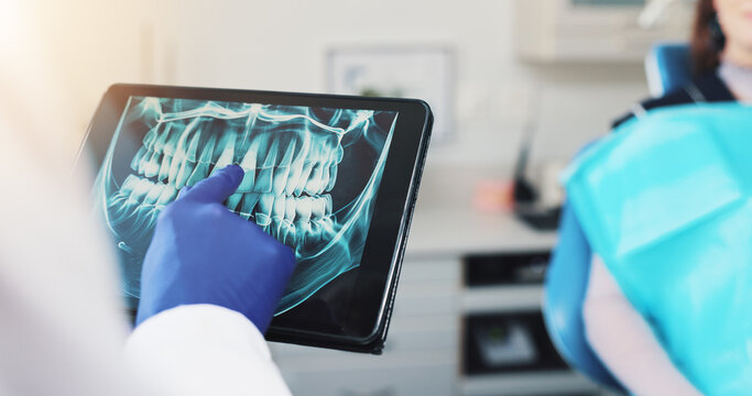 Hands, dentist and tablet screen for x ray, teeth diagnosis or plan for healthcare treatment. Person, patient and dental surgeon with digital tech for tooth structure, advice or orthodontic procedure