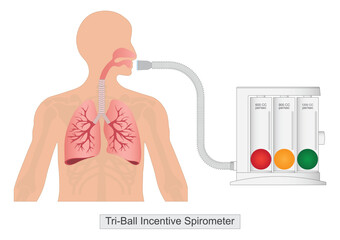 Tri ball incentive spirometer with human Lungs.