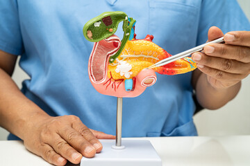 Pancreatitis, pancreatic cancer, Asian doctor with pancreas, gallbladder and bile duct human...