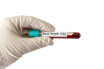 Fototapeta premium Gloved hand holding blood sample tube with red liquid isolated on transparent background