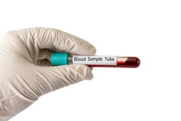 Gloved hand holding blood sample tube with red liquid isolated on transparent background