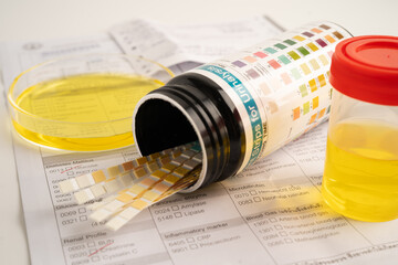 Urinalysis, urine cup with reagent strip pH paper test and comparison chart in laboratory.