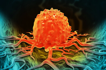 Cancer cells. Cancer outbreak and treatment for malignant cancer cells in a human body. 3d illustration