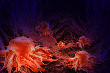 Cancer cells. Cancer outbreak and treatment for malignant cancer cells in a human body. 3d illustration