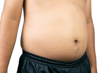 Naklejka premium A fat man shows fat deposits. The concept of not proper nutrition, sedentary lifestyle. Overweight treatment