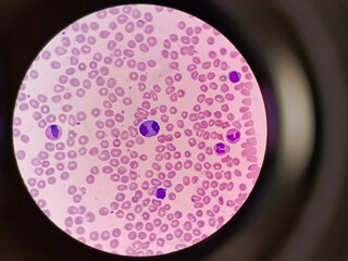 Mitosis in a Blood Cell. Cellular Division Process in Blood Cells.