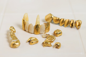 Golden crowns of teeth and other artificial teeth