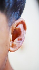 Dermatitis or skin conditions affecting the outer ear appear as red patches, caused by fungal...