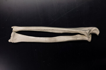 Human Radius Bone with Ulna Model
