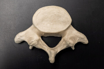 Lumbar Vertebra Bone Model Viewed from Above