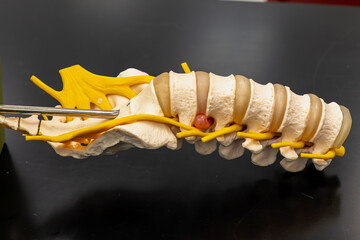 Lumbar Spine Model with Nerve Structures