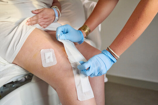 Nurse’s gloved hands cover a large wound with a dressing as part of postoperative care after knee arthroplasty