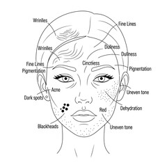 A diagram of a womans face showing various skin problems like acne, wrinkles, and pigmentation isolated on white background