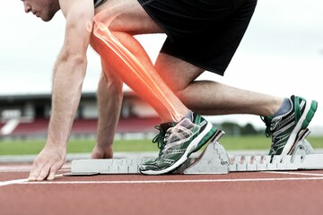 Runner experiencing leg pain