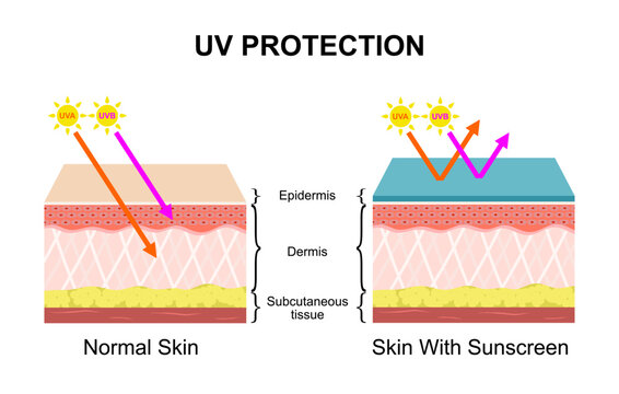 Human skin uv rays protection, before and after sunscreen. Sun uva, uvb epidermis damage prevention lotion. Skin sunburn vector infographic. Illustration of sunburn and sunblock ultraviolet