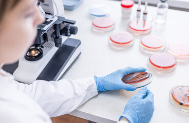 Scientist working with mold and fungal cultures in petri plate in the microbiology lab....