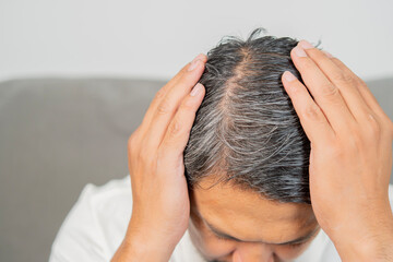 Fototapeta premium Close-up of man's head showing gray hair at roots, parting, and scalp is visible, indicating aging.