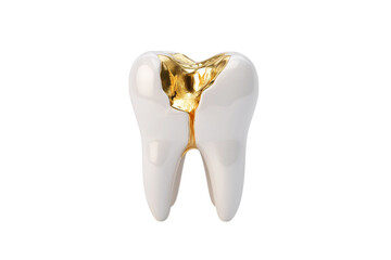 beautiful tooth with gold filling  isolated on white background