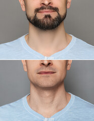 Man before and after shaving on grey background, closeup. Collage of photos