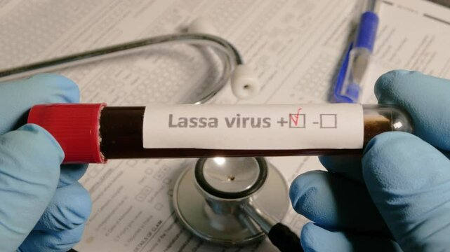 Doctor holding lassa virus positive blood test tube