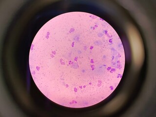 Trichomonas Under Microscope — Protozoan Parasite Causing Trichomoniasis