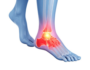 X-ray image showing human ankle joint with signs of pain or inflammation isolated on white background
