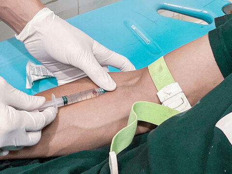 A male nurse is injecting a pain reliever anesthetic into a patient's hand