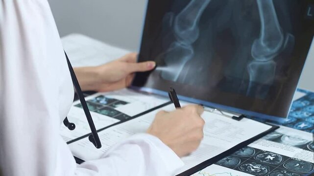 doctors view x rays with excellent quality