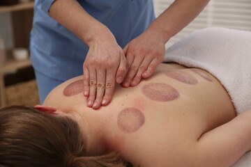 Cupping therapy. Woman receiving professional massage in spa salon, closeup