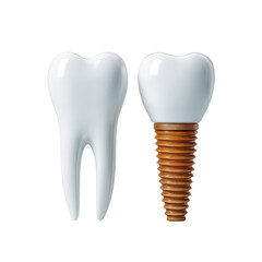 Dental implant and healthy tooth isolated on transparent background

