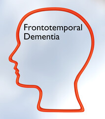 Frontotemporal Dementia concept