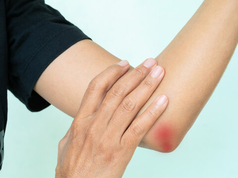 Elbow pain woman injury bone ache arm hand acute tendon Body physical muscle anatomy sprain disease arthritis broken, gout old human illness numbness tingling patient, concept health care.