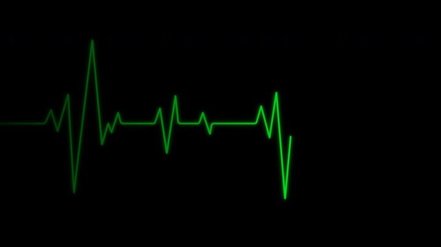 EKG Cardiograph heartbeat flatline monitoring on black background. 4K video