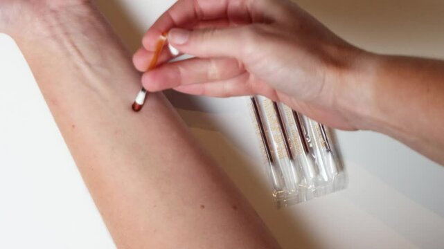 Woman disinfecting an arm with a cotton swab iodine. Iodophor swab.