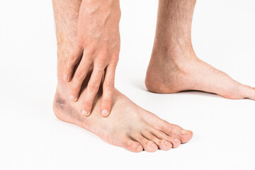 Man Holding Bruised Ankle After Injury
