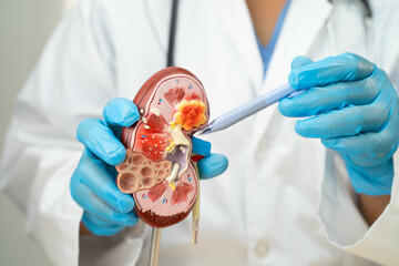 Chronic kidney disease, doctor with model for treatment urinary system, urology, Estimated...