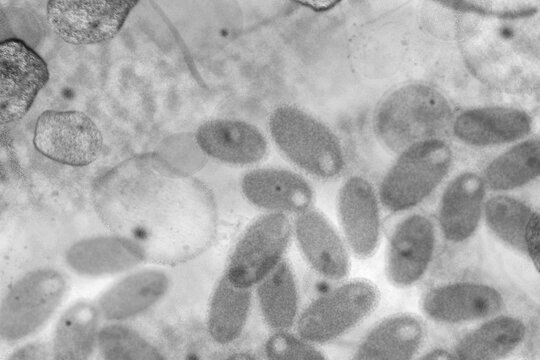 Symbolic illustration of infectious viruses under the microscope, for example influenza viruses, smallpox, measles or similar. Medical research and investigation of diseases and healthcare concept.